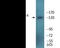 Insulin Receptor Substrate 1 antibody, EKC2010, Boster Biological Technology, Western Blot image 