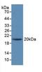 Interleukin 1 Receptor Antagonist antibody, LS-C292459, Lifespan Biosciences, Western Blot image 