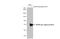 Neutrophil Cytosolic Factor 2 antibody, GTX132967, GeneTex, Western Blot image 