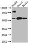 Cytochrome P450 Family 17 Subfamily A Member 1 antibody, CSB-RA554990A0HU, Cusabio, Western Blot image 