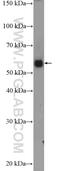 Plasma protease C1 inhibitor antibody, 12259-1-AP, Proteintech Group, Western Blot image 