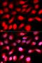 Zinc Finger E-Box Binding Homeobox 1 antibody, LS-C334155, Lifespan Biosciences, Immunofluorescence image 