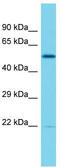 Ephrin B2 antibody, TA344567, Origene, Western Blot image 