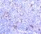 Integrin Subunit Alpha E antibody, A07091-1, Boster Biological Technology, Immunohistochemistry paraffin image 