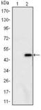 Ataxin 1 antibody, MA5-15735, Invitrogen Antibodies, Western Blot image 