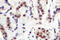 Signal Transducer And Activator Of Transcription 5A antibody, LS-C177958, Lifespan Biosciences, Immunohistochemistry paraffin image 
