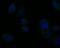 Tyrosine Kinase 2 antibody, NBP2-76968, Novus Biologicals, Immunocytochemistry image 