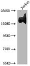 CD49D antibody, CSB-RA225859A0HU, Cusabio, Western Blot image 