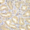 Engulfment And Cell Motility 3 antibody, STJ29262, St John