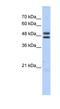 ERCC Excision Repair 8, CSA Ubiquitin Ligase Complex Subunit antibody, NBP1-54898, Novus Biologicals, Western Blot image 