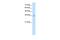 Transient Receptor Potential Cation Channel Subfamily M Member 5 antibody, PA5-41039, Invitrogen Antibodies, Western Blot image 