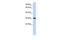 Transcription Factor A, Mitochondrial antibody, GTX44824, GeneTex, Western Blot image 