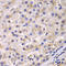 Eukaryotic Translation Elongation Factor 2 antibody, STJ23480, St John