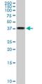 NSF Attachment Protein Gamma antibody, H00008774-M03, Novus Biologicals, Western Blot image 