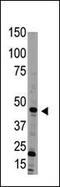 Bone Morphogenetic Protein 15 antibody, PA5-11712, Invitrogen Antibodies, Western Blot image 