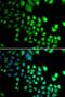 RB Binding Protein 5, Histone Lysine Methyltransferase Complex Subunit antibody, LS-C346158, Lifespan Biosciences, Immunofluorescence image 