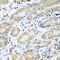 Eukaryotic Translation Initiation Factor 1A X-Linked antibody, LS-C334379, Lifespan Biosciences, Immunohistochemistry paraffin image 