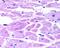HIF-2-alpha antibody, NB100-122, Novus Biologicals, Immunohistochemistry paraffin image 