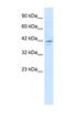 Zinc Finger MYM-Type Containing 5 antibody, MBS835344, MyBioSource, Western Blot image 