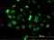 Zinc Finger Protein 182 antibody, H00007569-M03, Novus Biologicals, Immunofluorescence image 