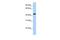 Abhydrolase Domain Containing 5 antibody, GTX16575, GeneTex, Western Blot image 