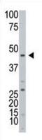 ADP-Ribosyltransferase 3 antibody, abx031579, Abbexa, Western Blot image 