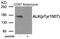 ALK Receptor Tyrosine Kinase antibody, GTX55395, GeneTex, Western Blot image 