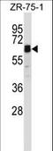 Signal Transducing Adaptor Molecule 2 antibody, LS-C161538, Lifespan Biosciences, Western Blot image 