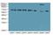 Transient Receptor Potential Cation Channel Subfamily M Member 2 antibody, LS-C395825, Lifespan Biosciences, Western Blot image 