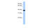Paired Box 2 antibody, 27-248, ProSci, Enzyme Linked Immunosorbent Assay image 