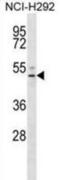 Sphingosine 1-phosphate receptor 4 antibody, abx032700, Abbexa, Western Blot image 