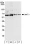 Protein kinase B antibody, A302-065A, Bethyl Labs, Western Blot image 