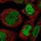 Zinc Finger Protein 570 antibody, PA5-56002, Invitrogen Antibodies, Immunofluorescence image 