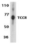 Interleukin-27 receptor subunit alpha antibody, MBS151246, MyBioSource, Western Blot image 