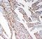 Matrix Metallopeptidase 14 antibody, PA2147, Boster Biological Technology, Immunohistochemistry paraffin image 