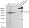 Golgi Associated, Gamma Adaptin Ear Containing, ARF Binding Protein 2 antibody, 14-174, ProSci, Western Blot image 