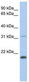 C-Type Lectin Like 1 antibody, TA337807, Origene, Western Blot image 