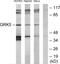 G Protein-Coupled Receptor Kinase 5 antibody, LS-C118866, Lifespan Biosciences, Western Blot image 