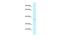 AlkB Homolog 1, Histone H2A Dioxygenase antibody, A06945, Boster Biological Technology, Western Blot image 