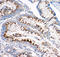 Insulin Like Growth Factor 2 Receptor antibody, LS-C313287, Lifespan Biosciences, Immunohistochemistry paraffin image 