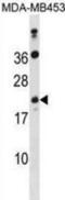 Distal Membrane Arm Assembly Complex 2 Like antibody, abx031464, Abbexa, Western Blot image 