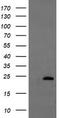 Ubiquitin Conjugating Enzyme E2 E3 antibody, TA504682, Origene, Western Blot image 