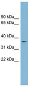 Transmembrane Serine Protease 12 antibody, TA333396, Origene, Western Blot image 