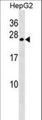 Crystallin Gamma B antibody, LS-C167068, Lifespan Biosciences, Western Blot image 