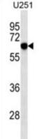 Receptor Like Tyrosine Kinase antibody, abx025282, Abbexa, Western Blot image 