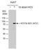 Hepatitis C Virus antibody, GTX103356, GeneTex, Western Blot image 