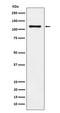 Cadherin 17 antibody, M06389, Boster Biological Technology, Western Blot image 