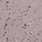 PTOV1 Extended AT-Hook Containing Adaptor Protein antibody, NBP2-68998, Novus Biologicals, Immunohistochemistry frozen image 