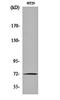 Matrix Metallopeptidase 2 antibody, orb161776, Biorbyt, Western Blot image 