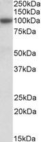 Glutathione S-Transferase Alpha 3 antibody, 42-445, ProSci, Western Blot image 